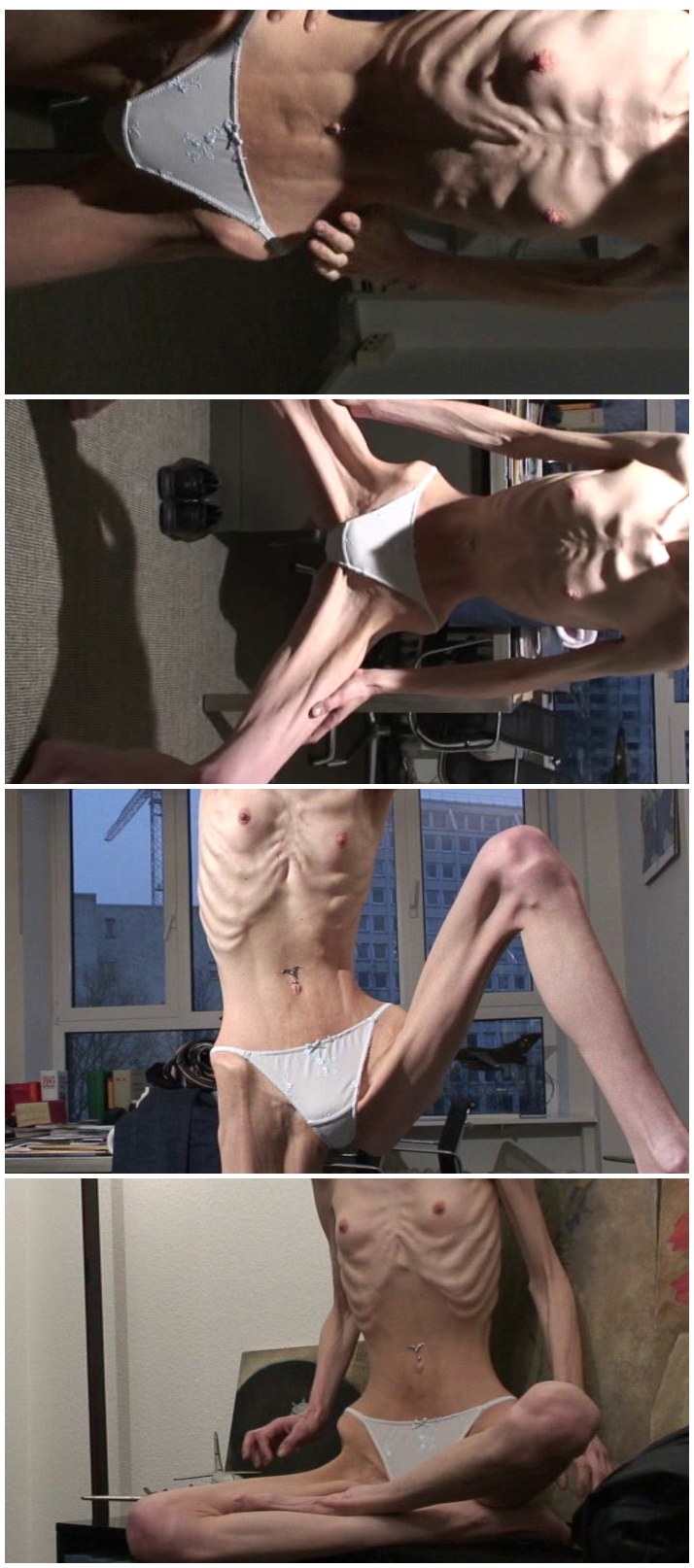 Anorexic Extreme Photos Porn