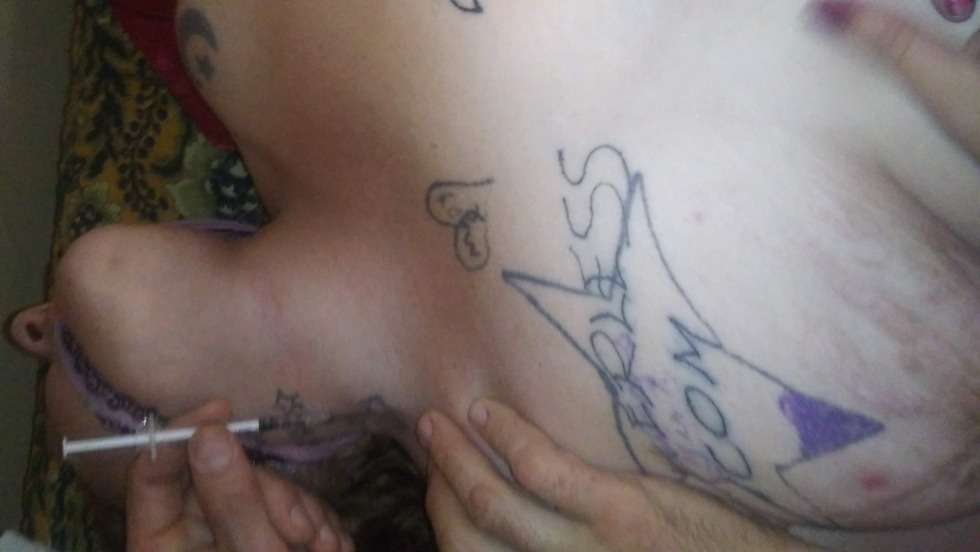 Cock Injections, Saline Injection, Fisting, Nurse