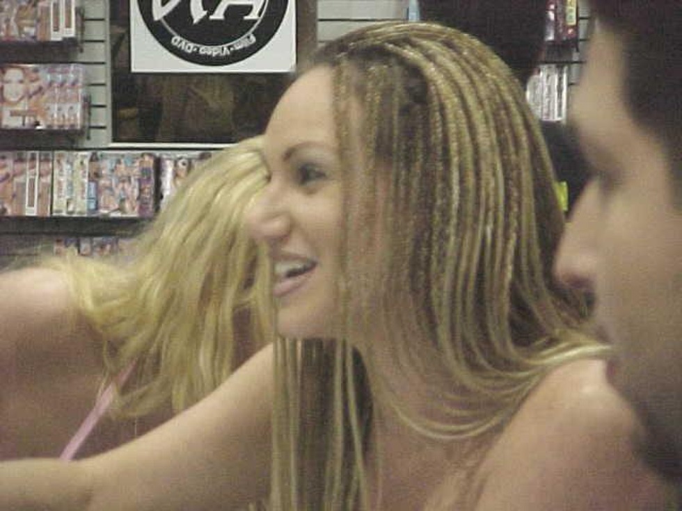 Aletta Ocean before surgery