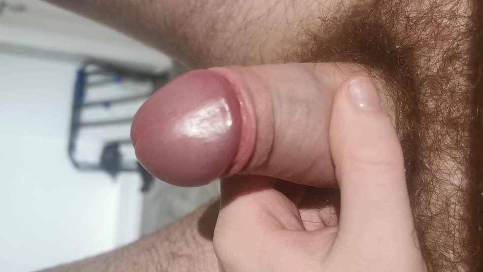 Hypertrophic phimosis