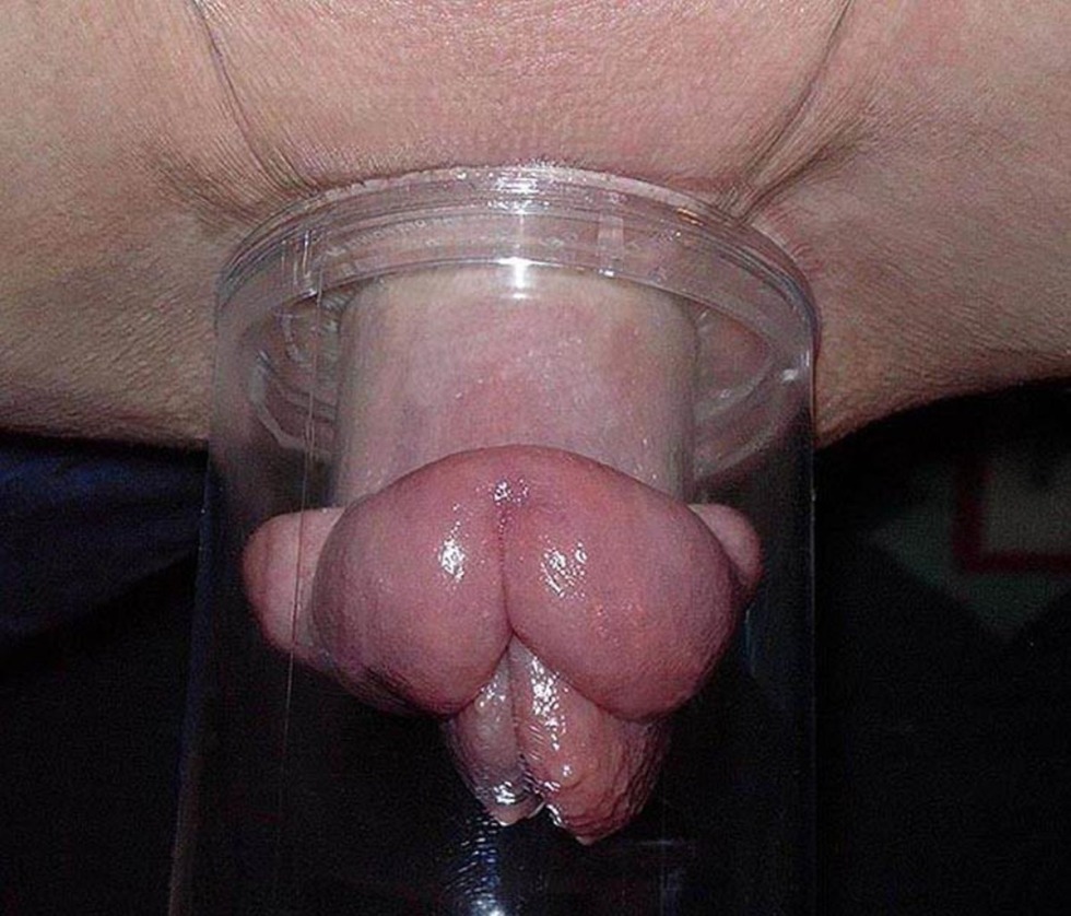 Vagina pumped up by pomp