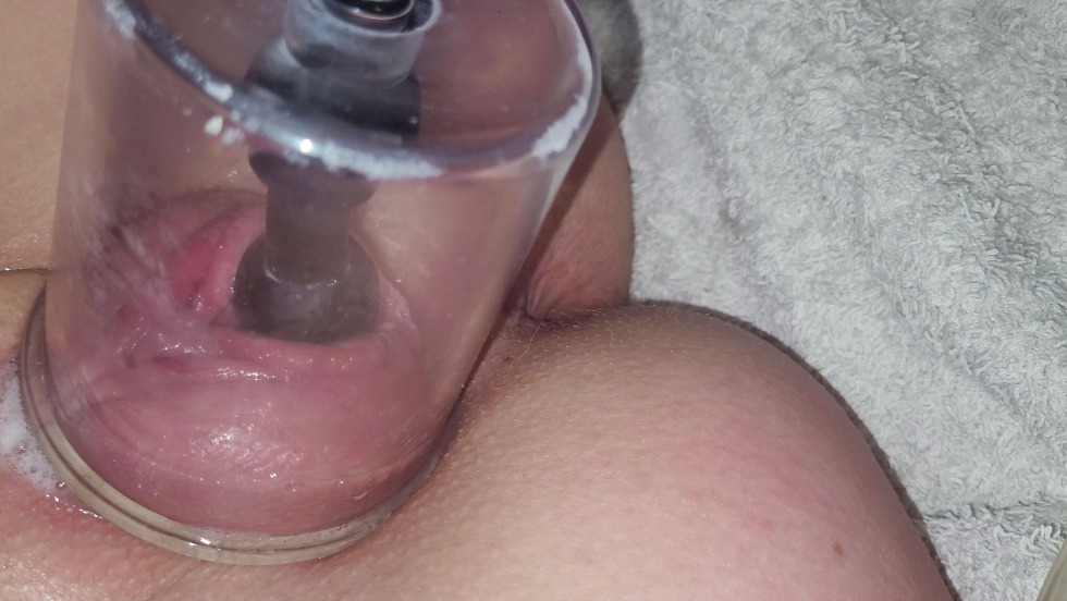 Vacuum pump on the vagina