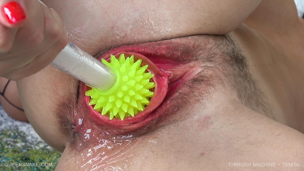 Transparent glass in vagina