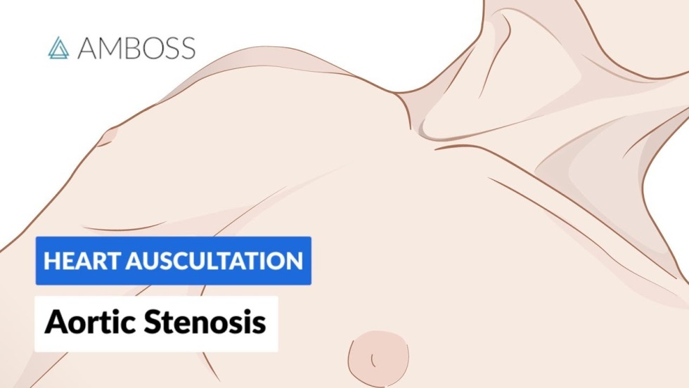 Aortic Valve Regurgitation Pathogenesis