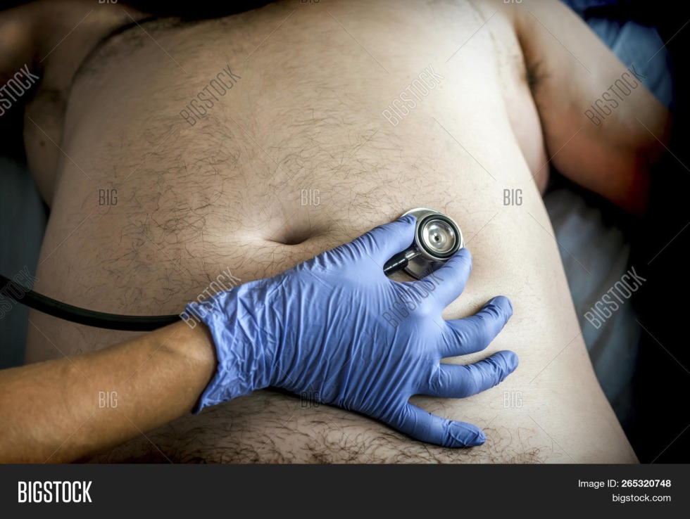 Topless stethoscope auscultation