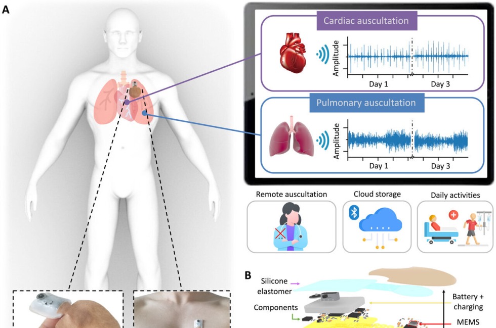 Arterial pressure is norm