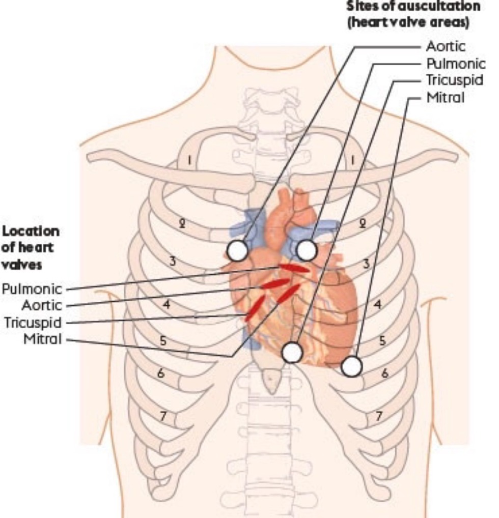 Accent of Heart Sound 2 Auscultation