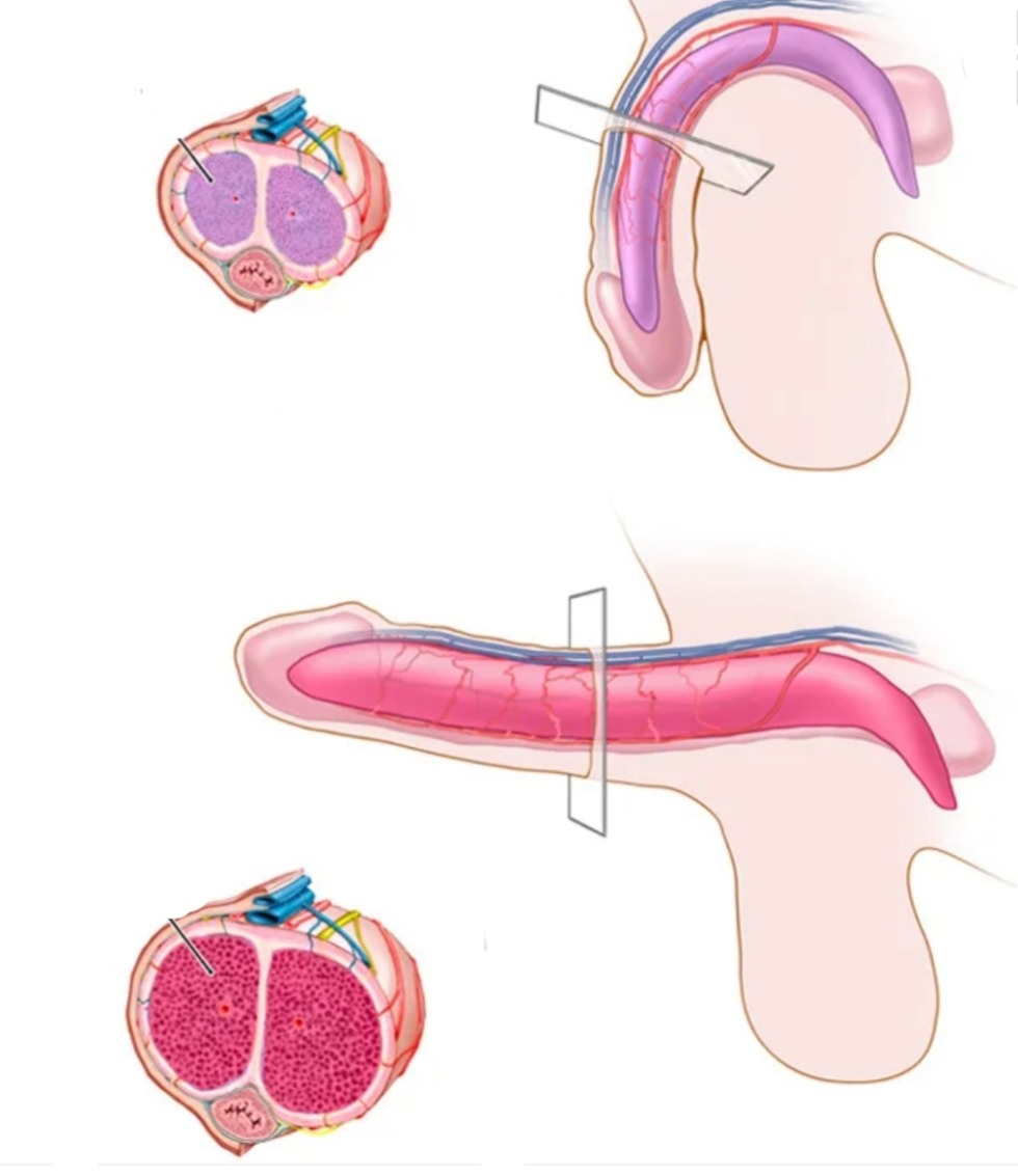Erectile disfunction