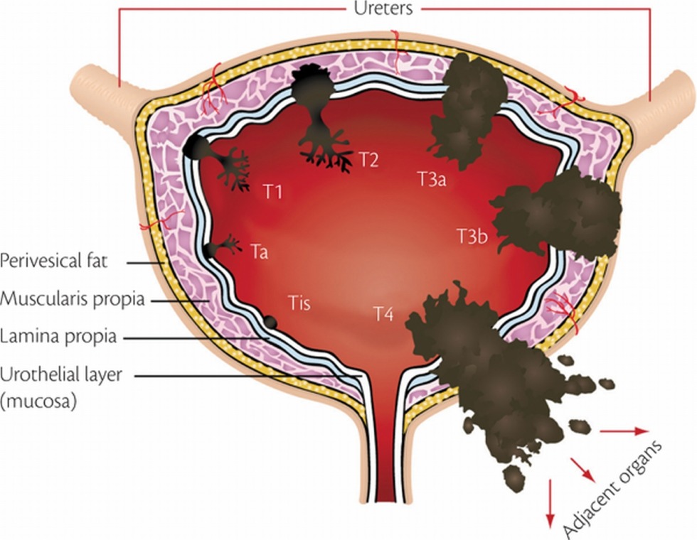 Anime comics about fat women