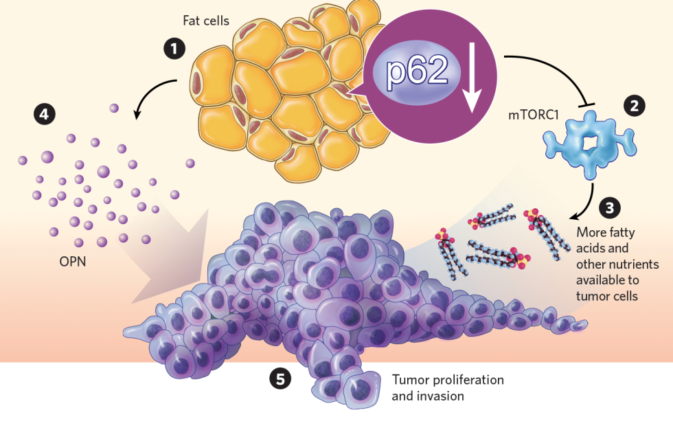 Lipid cell tumors