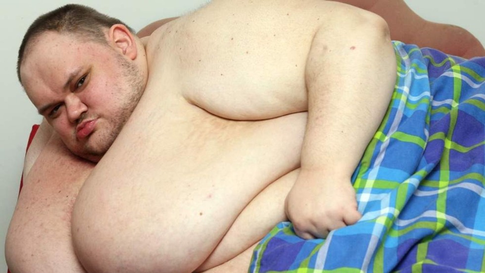 • BRCA2: Breast Cancer 2, Early Ones