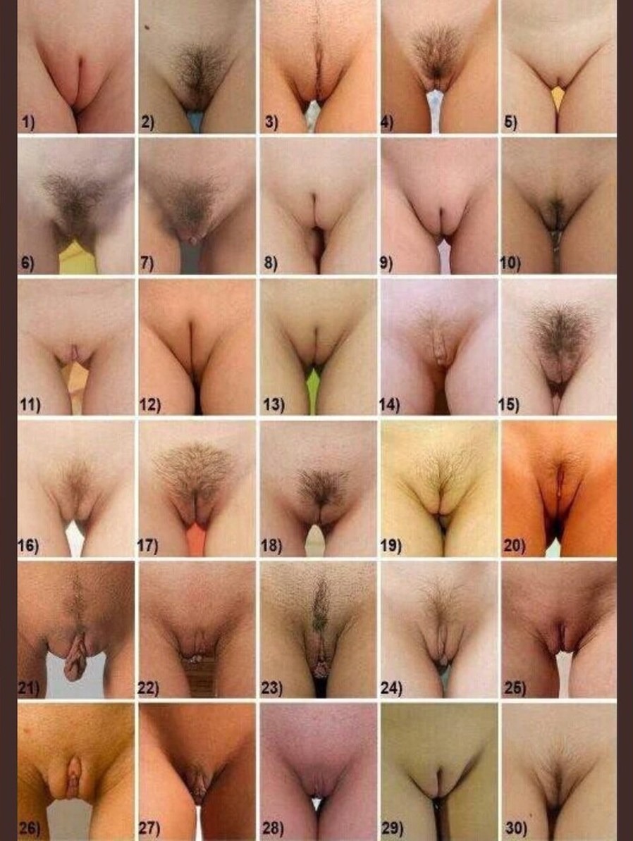 Different forms of female genitals