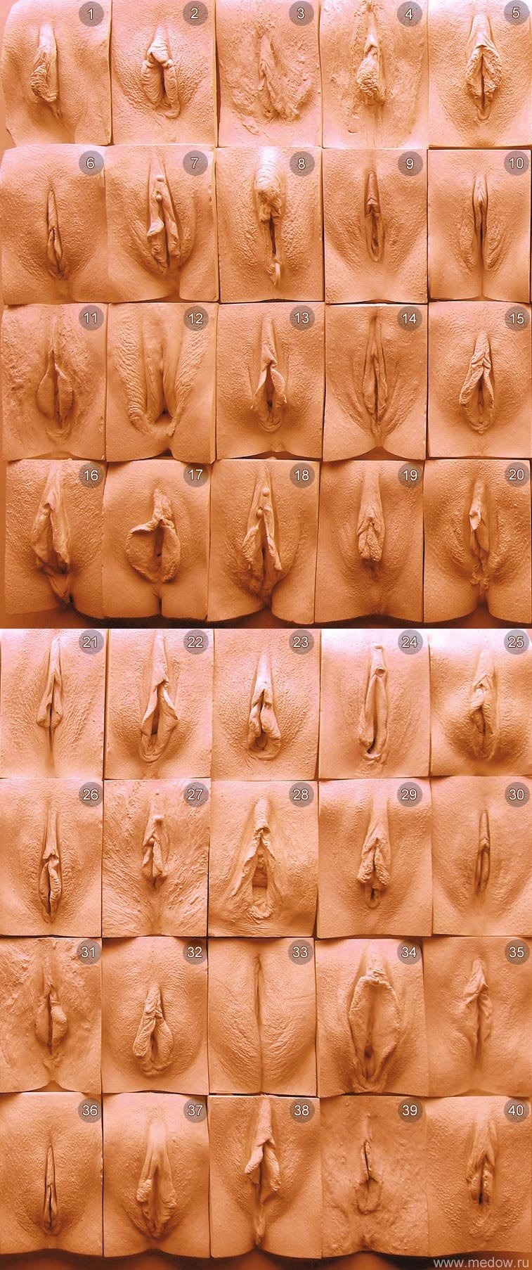 Varieties of female vaginas