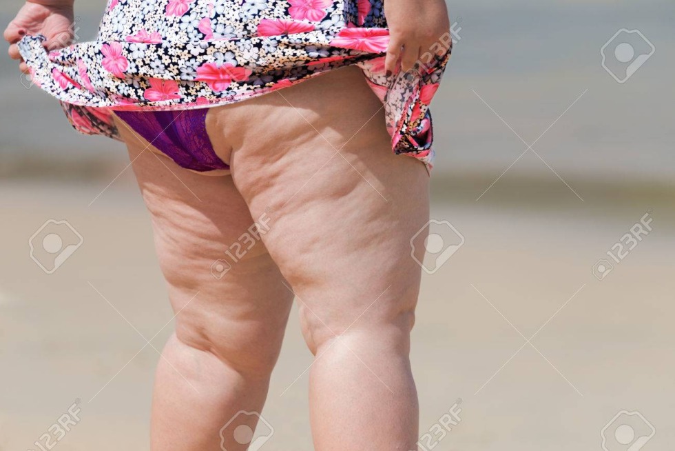 Naked middle -aged women