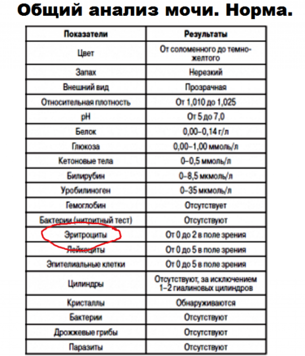 Irina Tonsheva in a swimsuit