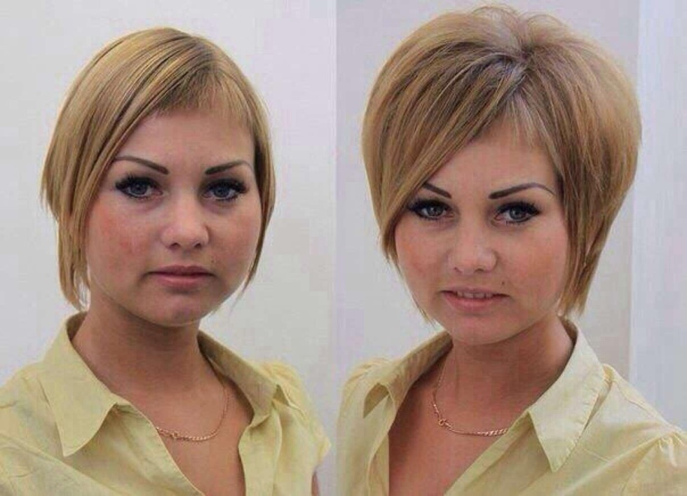 Buffan's basal volume