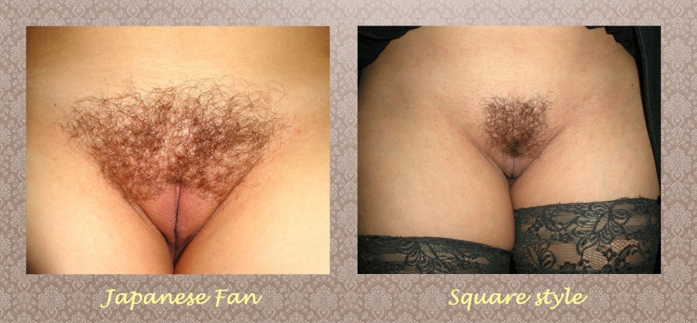 Labiafiling Majora Labia Hyaluronic Acid Injection