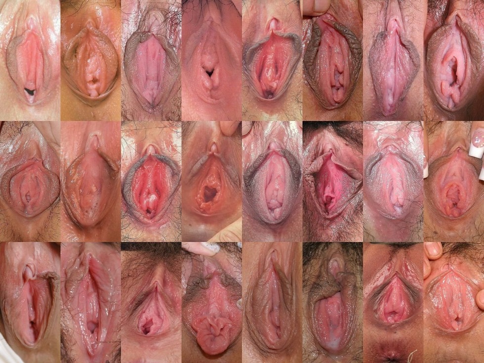 Forms of female genital organs