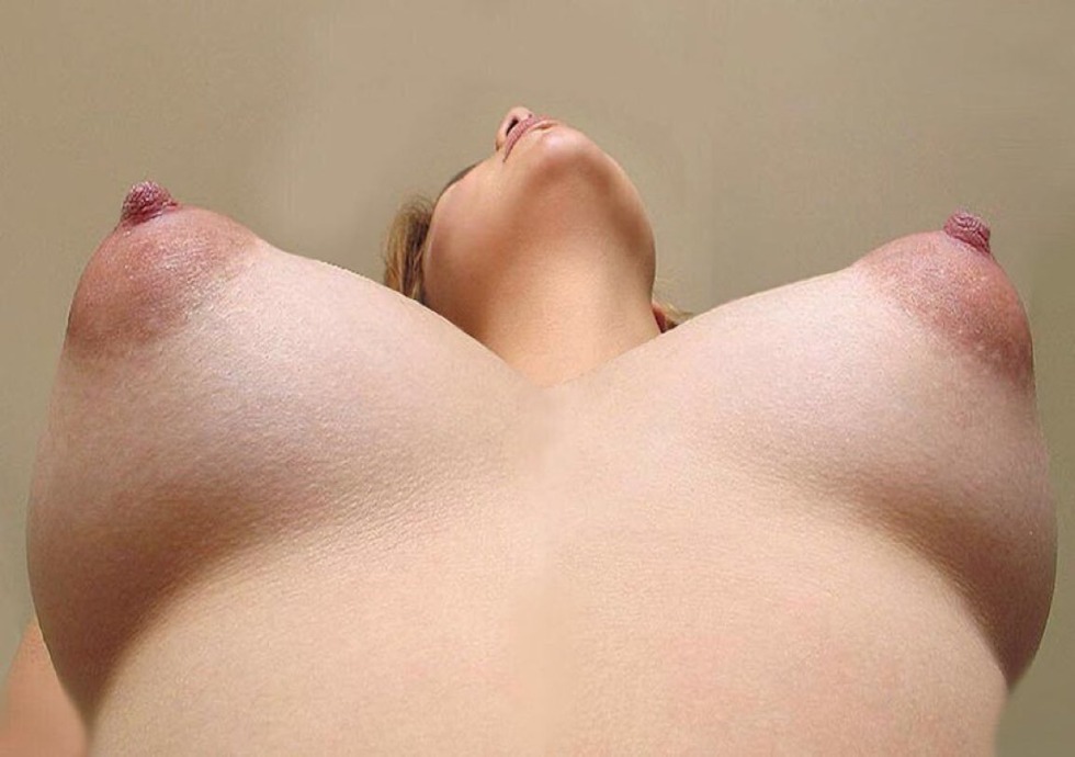 Unusual breasts are private