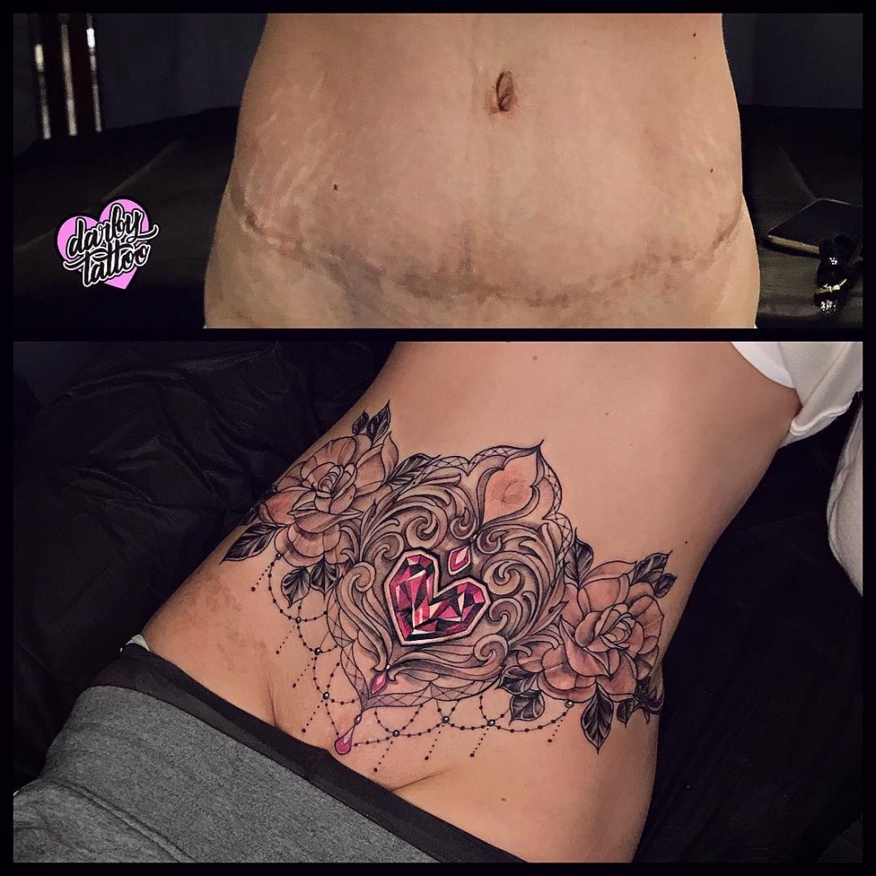 Tattoo Crossing Scars on the stomach