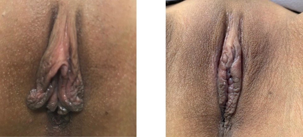 Dominica Chibova 2020 Vagina