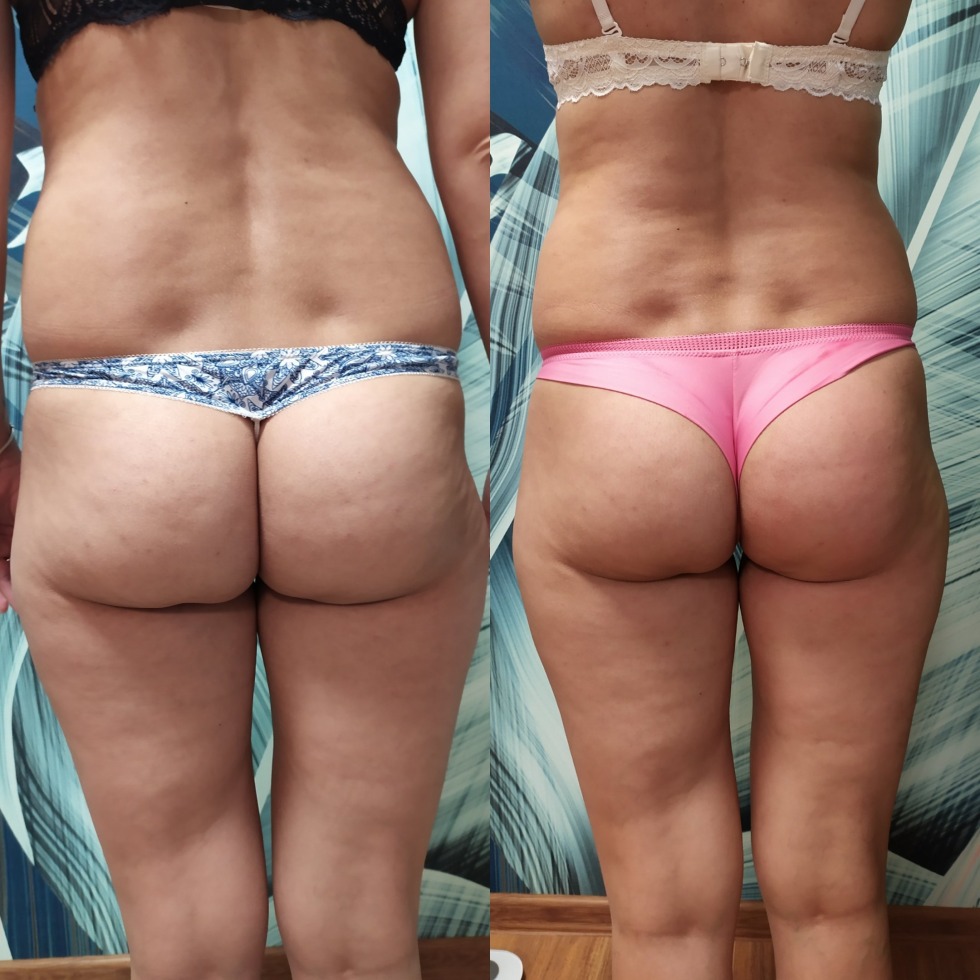 Naked pussies of thick nudists