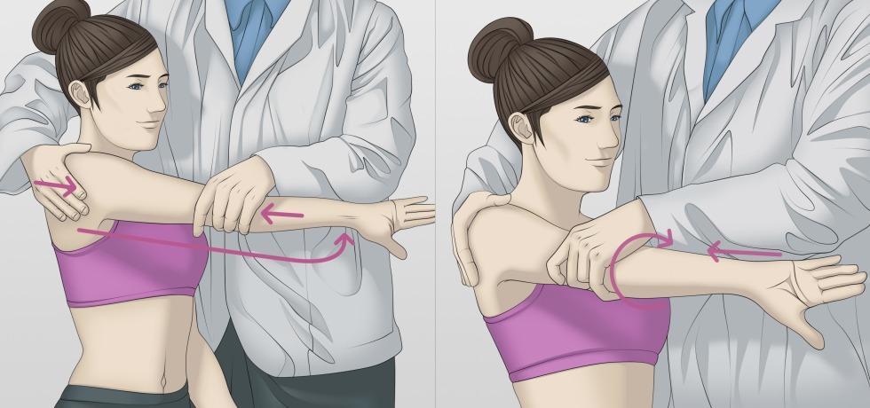 Bilateral orchyctomy