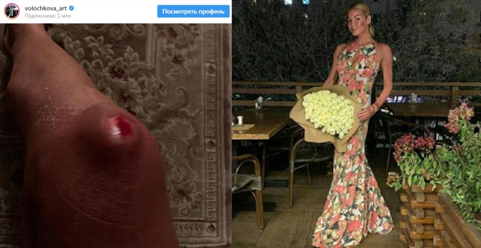 Anastasia Volochkova on stage