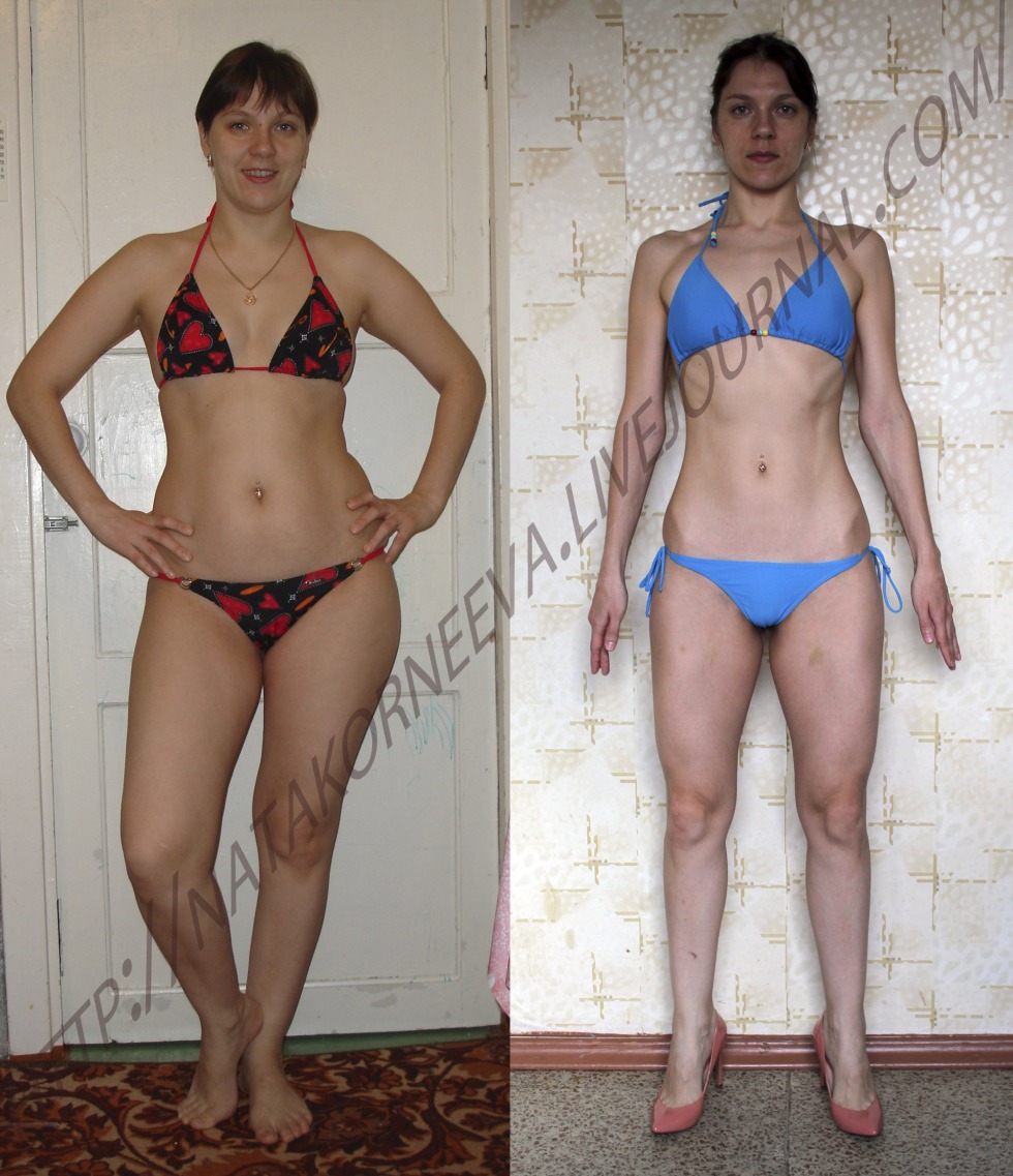 Rubore resection before and after