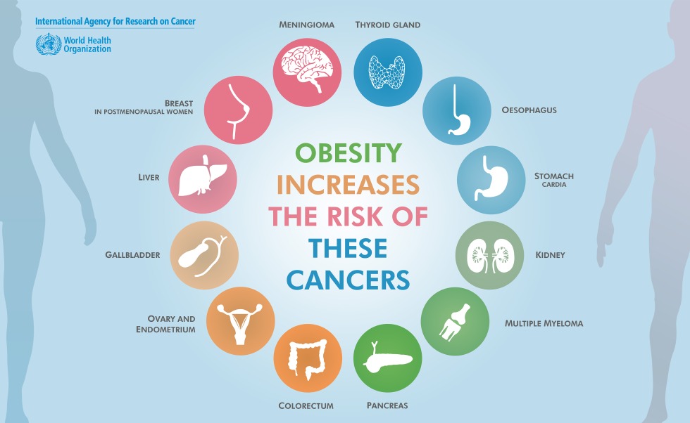 Obesity and Cancer