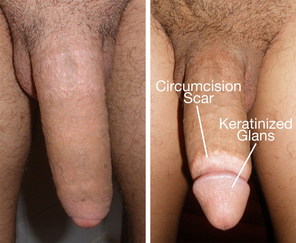 Shaved Circumcified Flaccid Penis at home