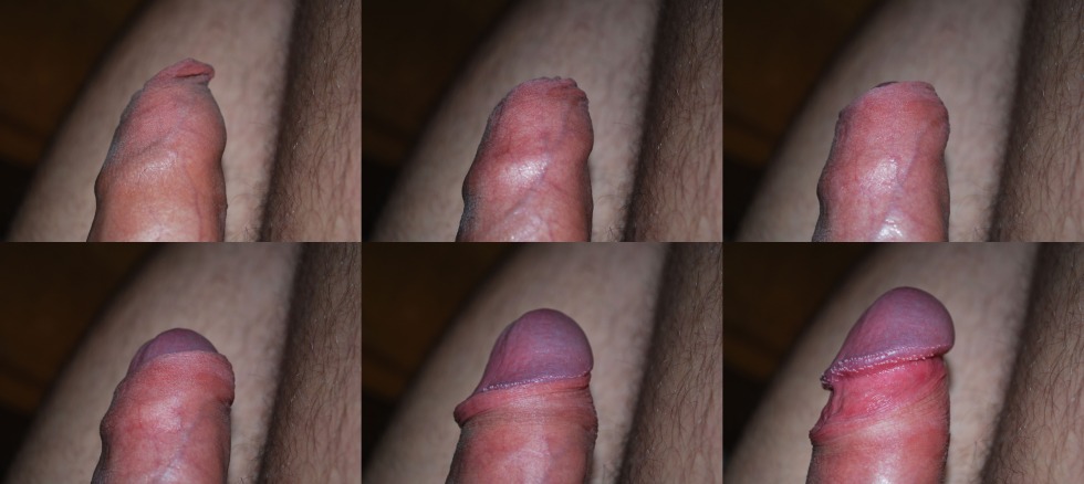 Male penis with foreskin