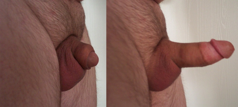 Penis before and after an erection