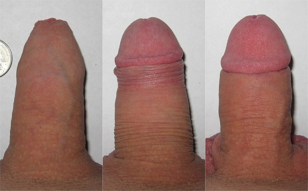 Little male members close -up