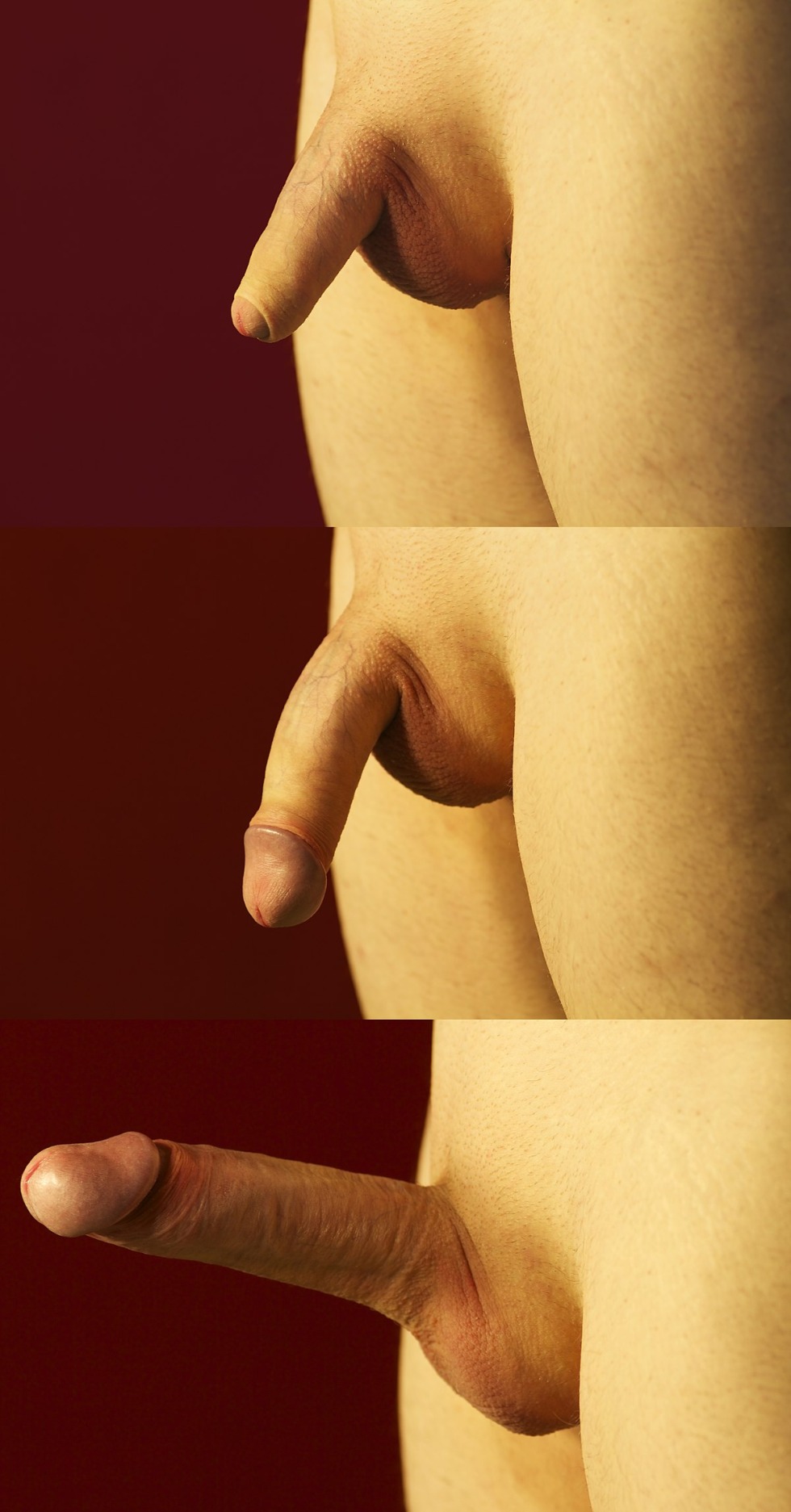 Forms of male genitalia