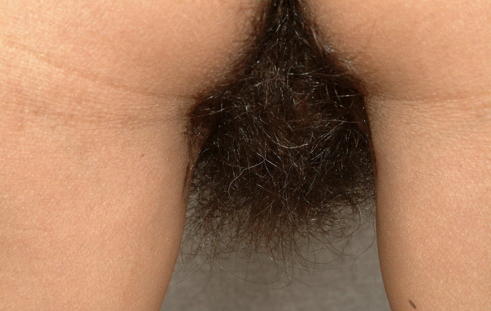 Very hairy female pubis