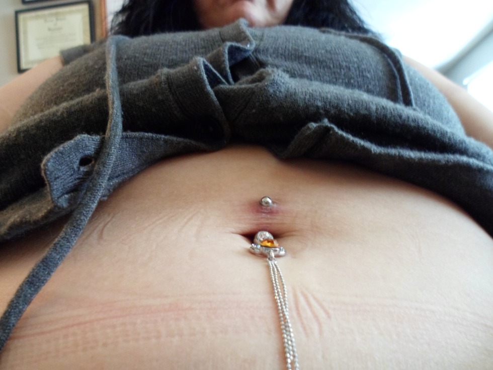 Unusual breast piercing