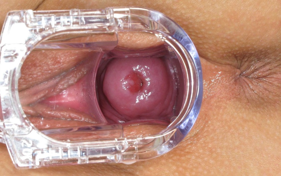 The vagina of a woman from the inside