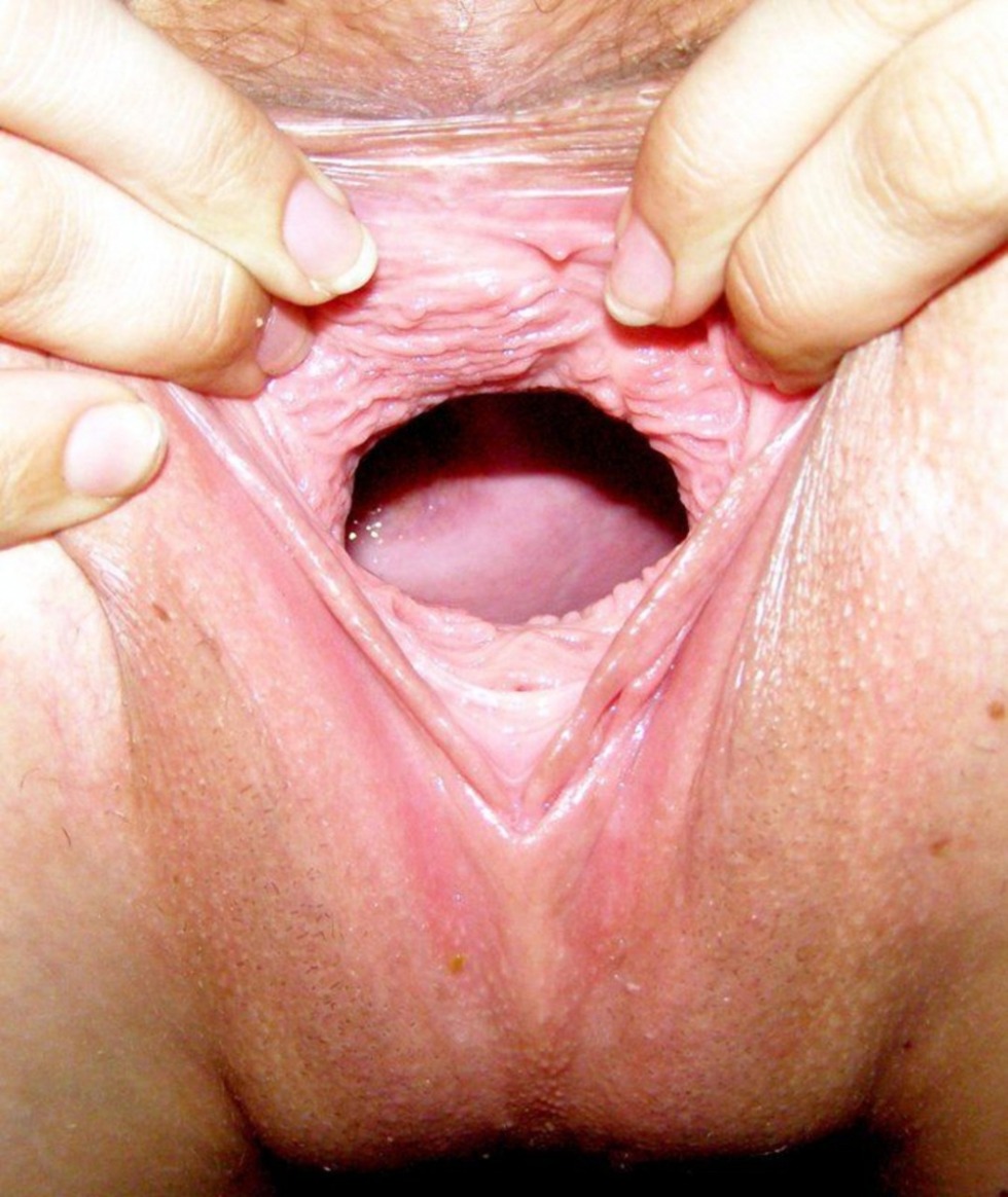 Women's vagina close -up