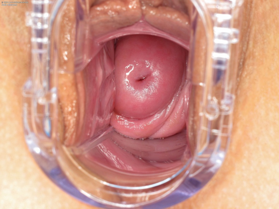 Vagina and uterus from the inside