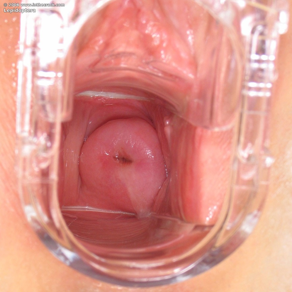 Member Cums inside the vagina