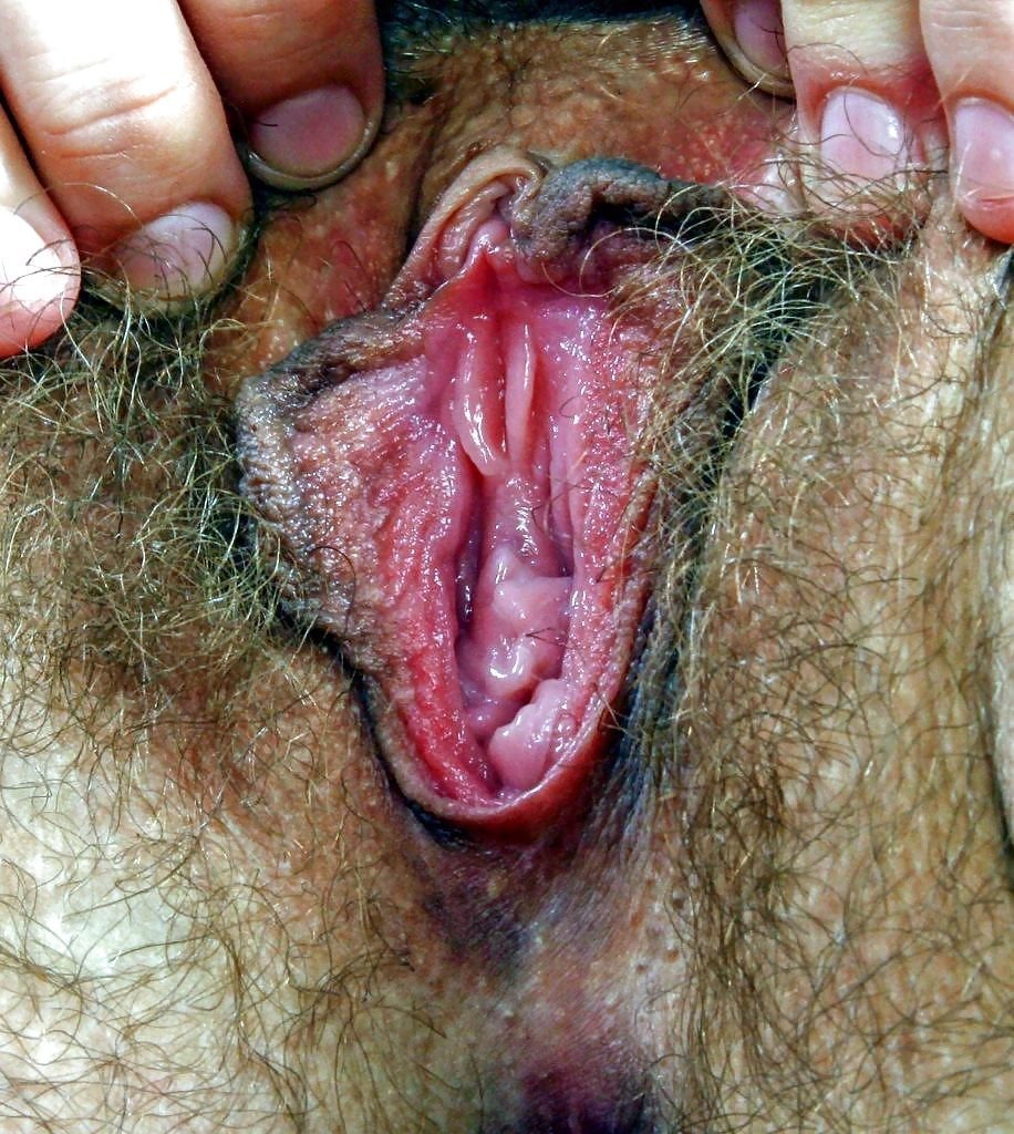 The most ugly vagina