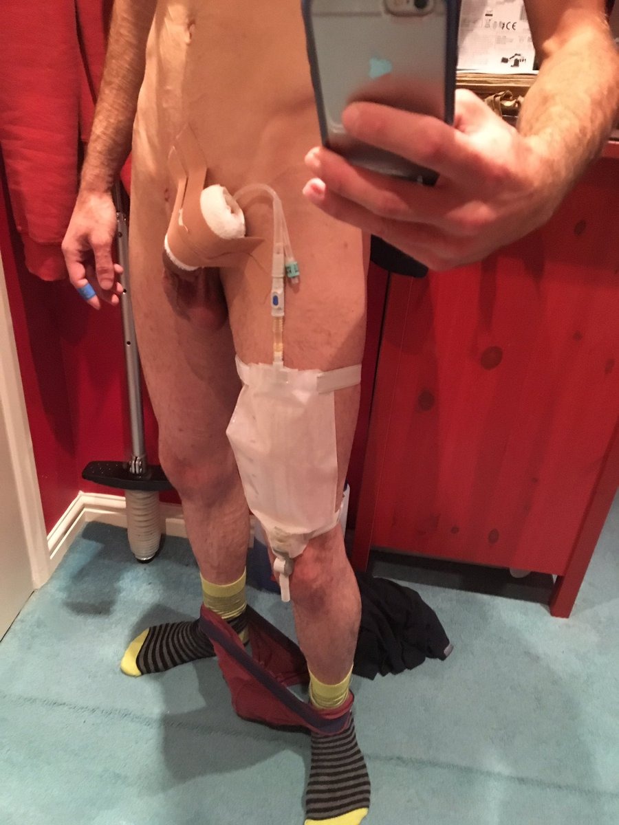 Hard catheter in a member