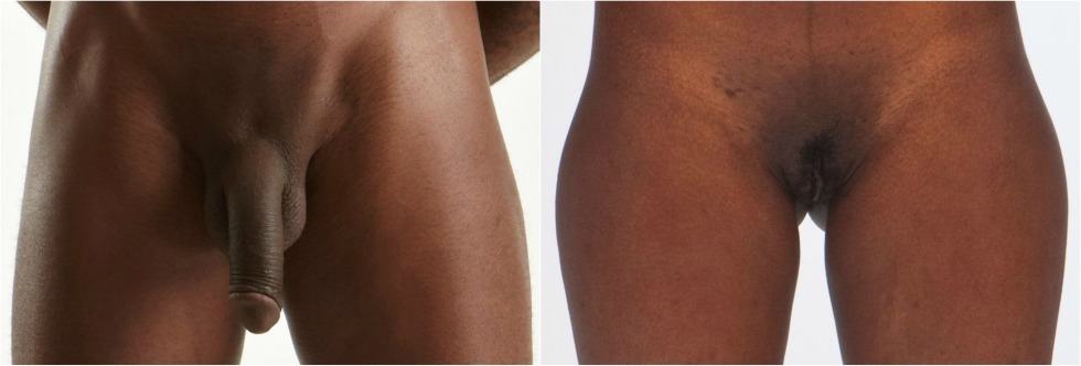 Male and female genitals