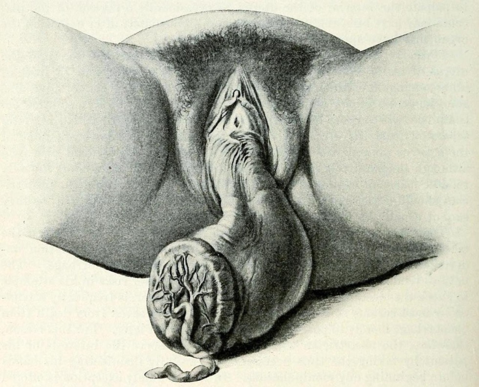 Women's genitals in context