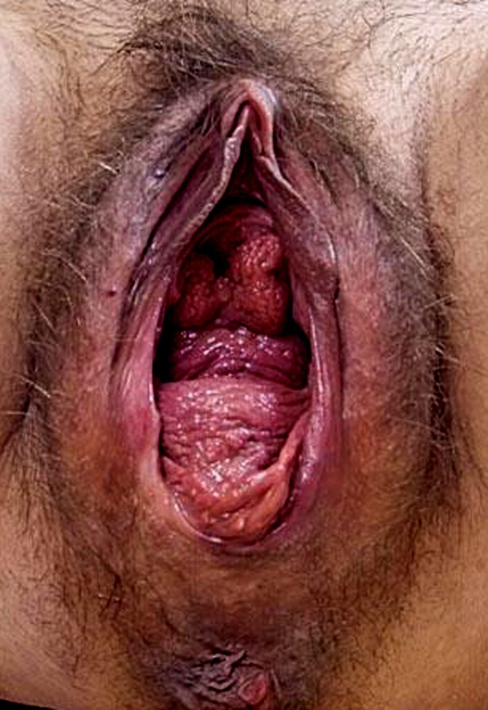 Terrible female vagina