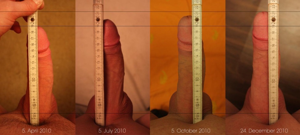 Jelking penis before and after