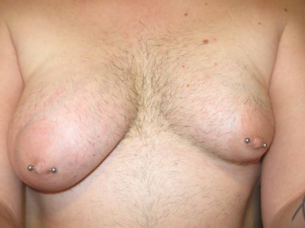 Hairy tits in women