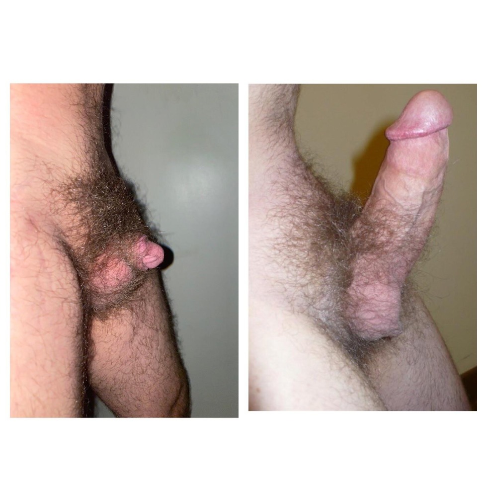 Hairy member erection