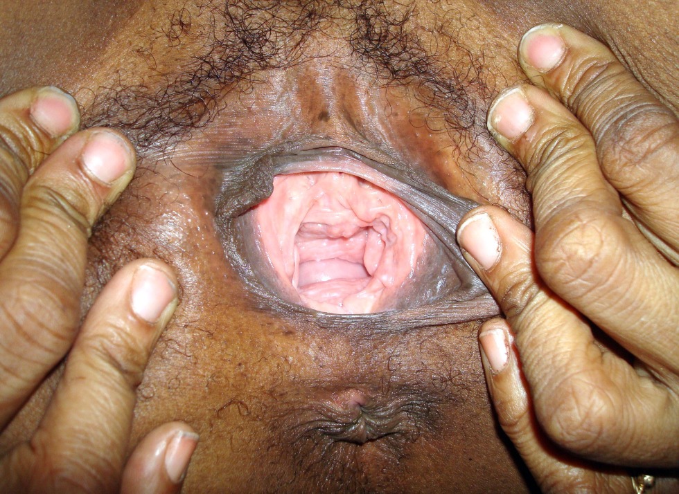 Vagina of a fat old black woman